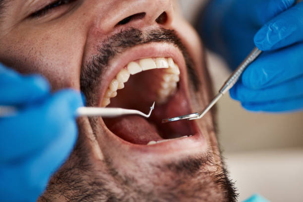Best Emergency Dental Care for Abscessed Tooth in Portage, MI